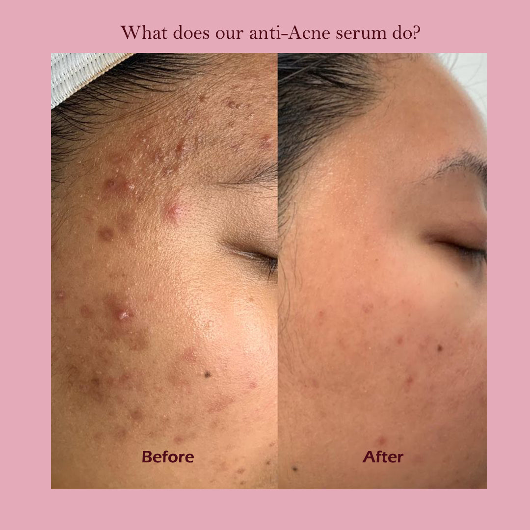 The Moist: Hydrating Serum