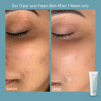 The Beauty: Moist Cleanser