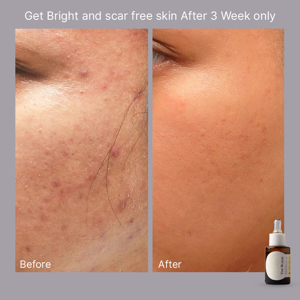 The Bloom: Vitamin C Serum